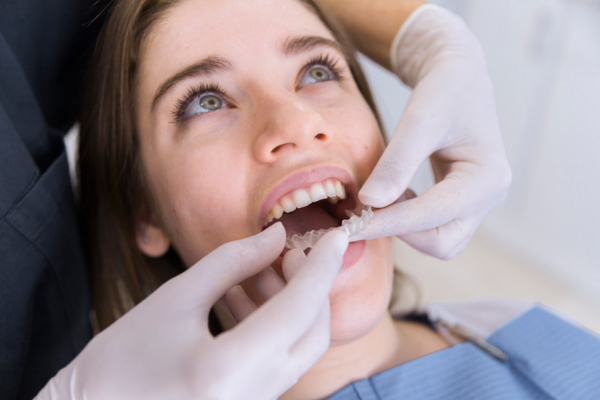 Dispensación directa de ortodoncia Invisalign